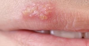 Method Discovered By Accident 