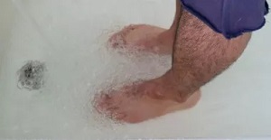 This Man Cured His Nail Fungus In 10 Minutes! (And He'll Show You How)